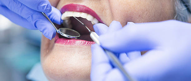 Best Emergency Cosmetic Dentistry (e.g., broken veneers) in Wyldwood, TX
